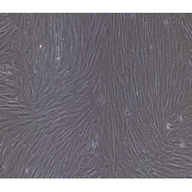 Human Primary Adipose Stem Cells