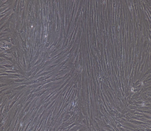 Human Primary Adipose Stem Cells