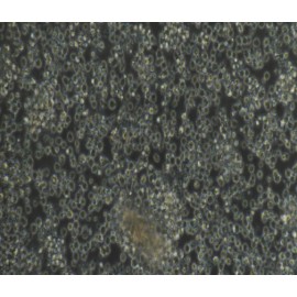 Human Primary B Lymphocytes Cells