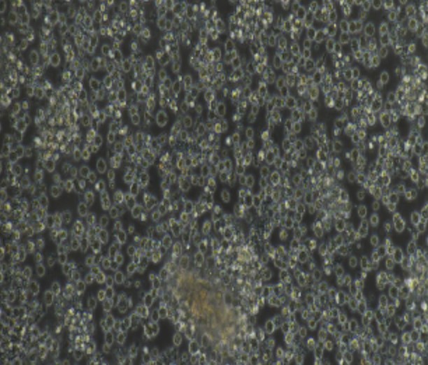 Human Primary B Lymphocytes Cells