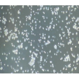 Human Primary Mononuclear Cells