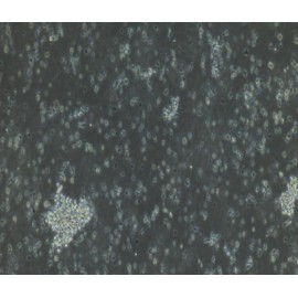 Human Primary NK Cells