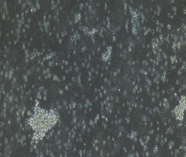 Human Primary NK Cells