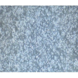 Human Primary Peripheral Blood Mononuclear Cells