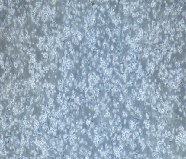 Human Primary Peripheral Blood Mononuclear Cells