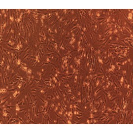 Human Primary Periodontal Ligament Fibroblasts Cells