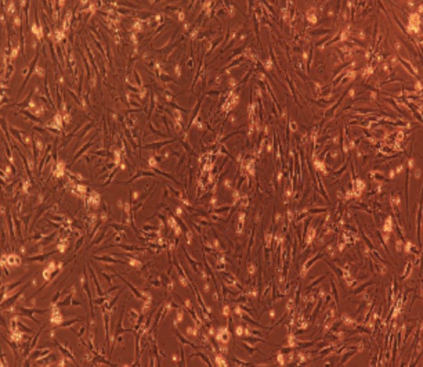Human Primary Periodontal Ligament Fibroblasts Cells