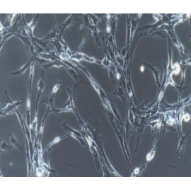Human Primary Retinal Microvascular Endothelial Cells