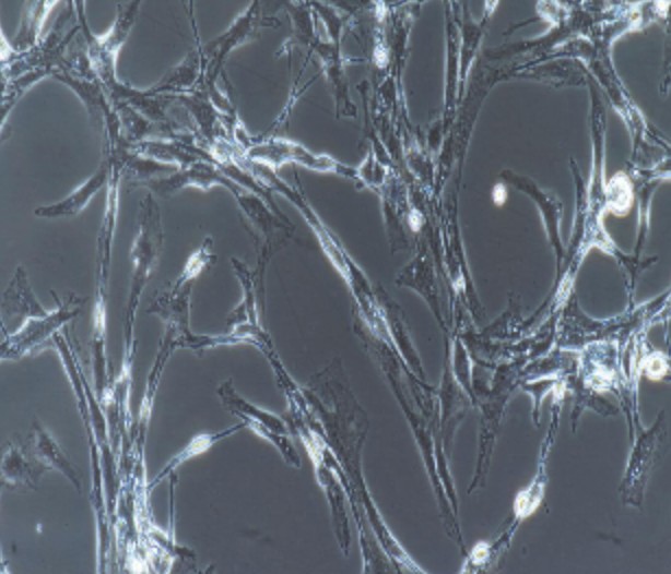 Human Primary Retinal Microvascular Endothelial Cells