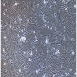 Human Primary Placental Mesenchymal Stem Cells