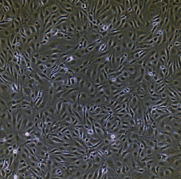 Human Primary Umbilical Vein Endothelial Cells