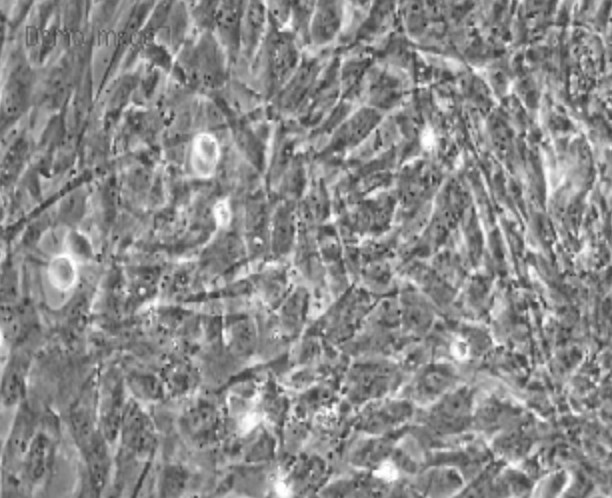 Human Primary Umbilical Artery Endothelial Cells