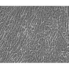 Human Primary Umbilical Vein Smooth Muscle Cells