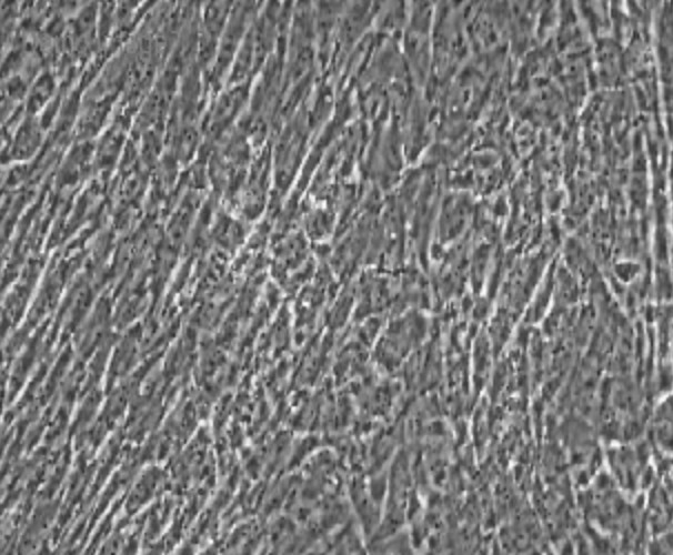 Human Primary Umbilical Vein Smooth Muscle Cells