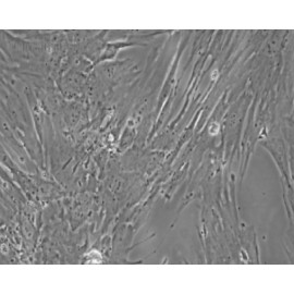 Human Primary Umbilical Artery Smooth Muscle Cells