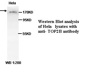 TOP2B Antibody (Rabbit Polyclonal)