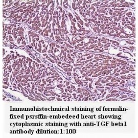 TGF beta1 Antibody (Rabbit Polyclonal)