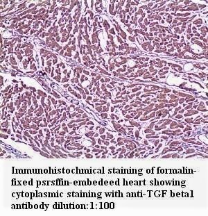 TGF beta1 Antibody (Rabbit Polyclonal)