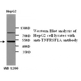TOP2B Antibody (Rabbit Polyclonal)
