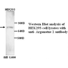 TOP2B Antibody (Rabbit Polyclonal)