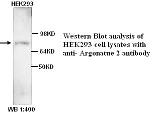TOP2B Antibody (Rabbit Polyclonal)