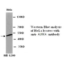 TOP2B Antibody (Rabbit Polyclonal)