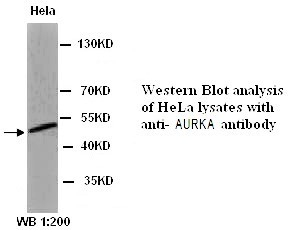 TOP2B Antibody (Rabbit Polyclonal)