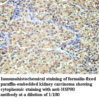 STK6 Antibody (Rabbit Polyclonal)