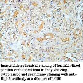 BAL Antibody (Rabbit Polyclonal)
