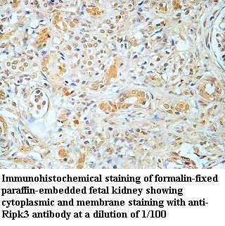 BAL Antibody (Rabbit Polyclonal)