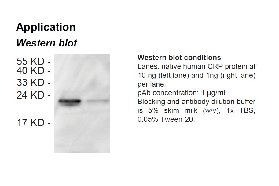 Rabbit anti-human C-reactive protein (CRP) polyclonal antibody