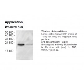 Rabbit anti-human C-reactive protein (CRP) polyclonal antibody