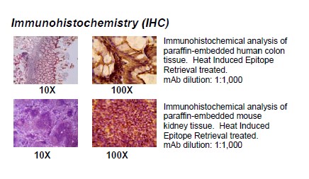 Rabbit anti-human Creatine kinase-MB (CKMB) monoclonal antibody, clone 8F1