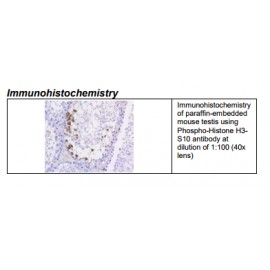 Rabbit anti-Phospho-Histone H3-S10 Monoclonal Antibody 
