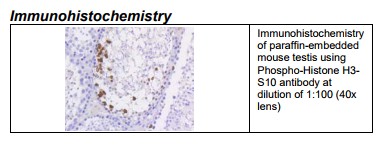 Rabbit anti-Phospho-Histone H3-S10 Monoclonal Antibody 