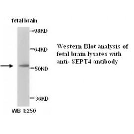 SEPT4 Antibody (Rabbit Polyclonal)