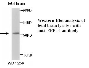 SEPT4 Antibody (Rabbit Polyclonal)