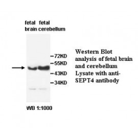 SEPT4 Antibody (Rabbit Polyclonal)