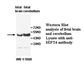 SEPT4 Antibody (Rabbit Polyclonal)