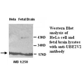 UBE2V2 Antibody (Rabbit Polyclonal)