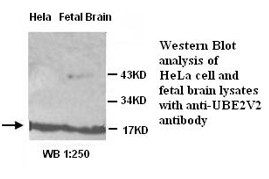 UBE2V2 Antibody (Rabbit Polyclonal)