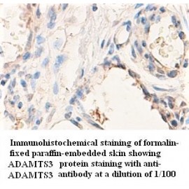 ADAMTS3 Antibody (Rabbit Polyclonal)