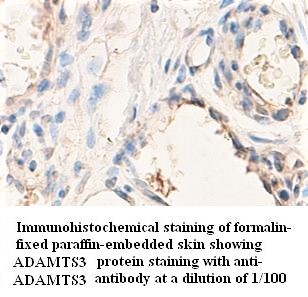 ADAMTS3 Antibody (Rabbit Polyclonal)