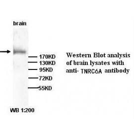 TNRC6A Antibody (Rabbit Polyclonal)