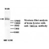 TNRC6A Antibody (Rabbit Polyclonal)