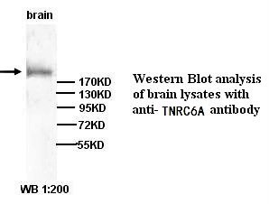 TNRC6A Antibody (Rabbit Polyclonal)