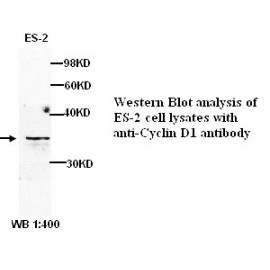 CCND1 Antibody (Rabbit Polyclonal)