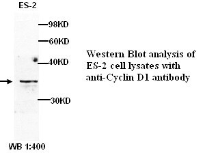 CCND1 Antibody (Rabbit Polyclonal)