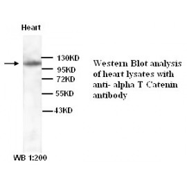 CTNNA3 Antibody (Rabbit Polyclonal)