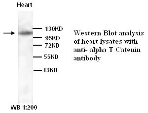 CTNNA3 Antibody (Rabbit Polyclonal)